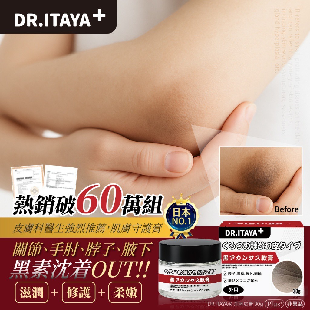 DR.ITAYA 黑棘皮膏 30g