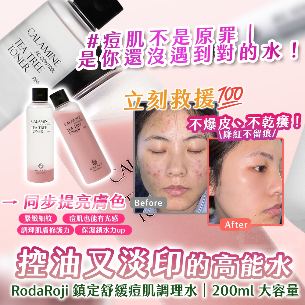 韓國製造 RodaRoji 鎮定舒緩痘肌調理水 大容量200ml