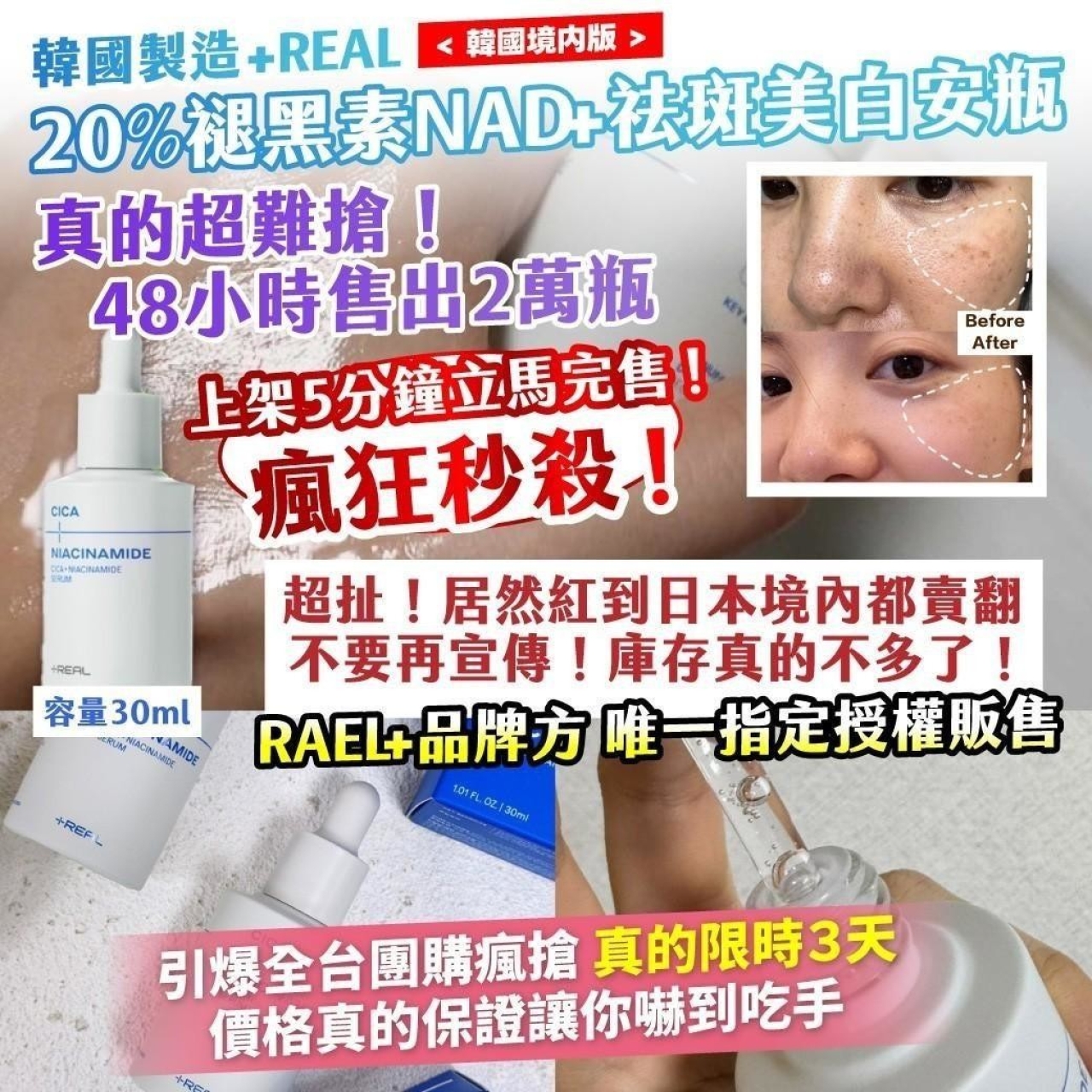 韓國製造+REAL 20% 褪黑素 NAD+ 祛斑美白安瓶