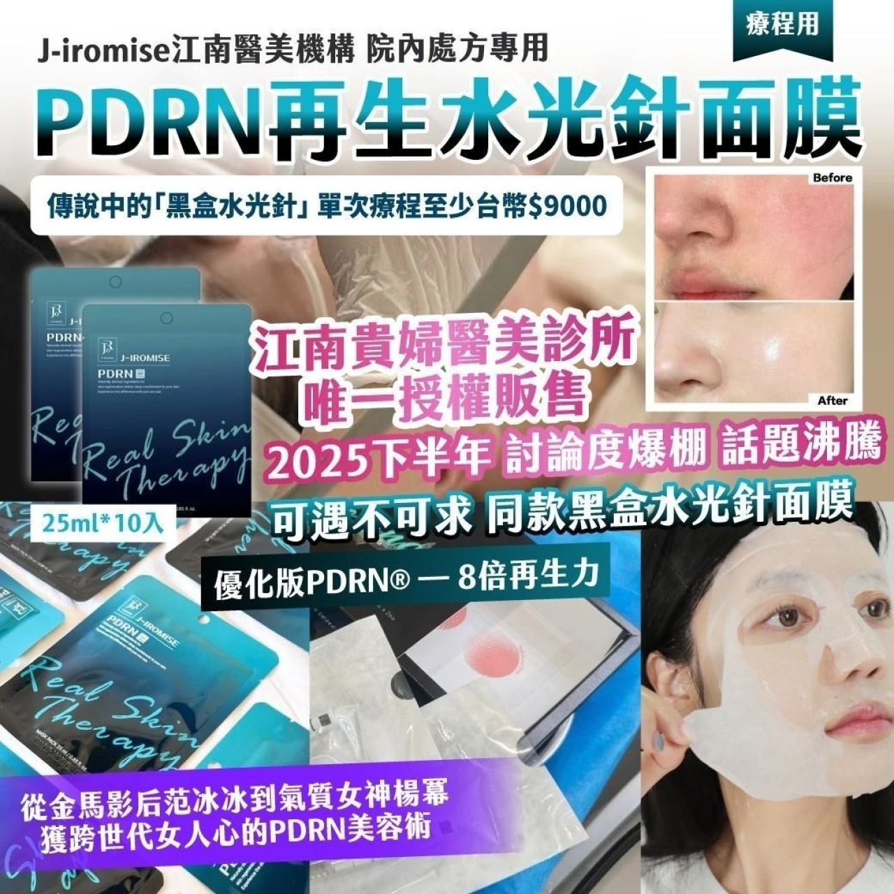 J-iromise江南醫美機構 院內處方專用 PDRN再生水光針面膜療程用25ml*10入