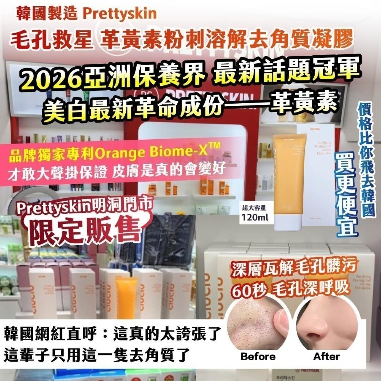 韓國製造 Prettyskin 毛孔救星 革黃素粉刺溶解去角質凝膠 120ml